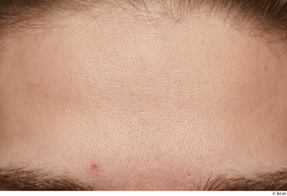 HD Arvid face forehead skin pores skin texture 0001.jpg